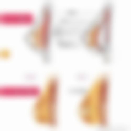 look郑州脂肪填充有名的整形医生排名；郑州芳艺、华领领衔，乔长顺、徐刚强技术精湛，全脸填充1.56w起口碑佳