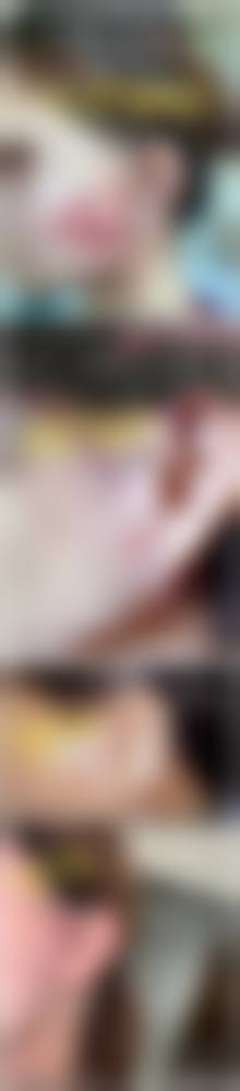 西安医学中 心眼部整形收费标准