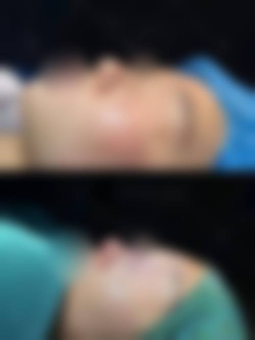 五、眼鼻胸整形价格区间分析