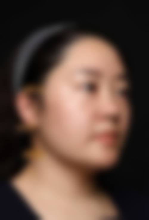 王乙立医生无痕筋膜提升口碑