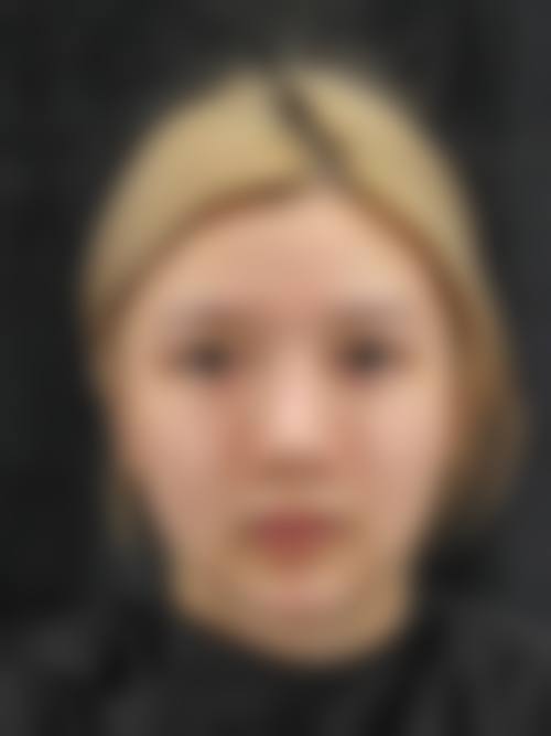 八、娄底德美医疗整形美容诊所真人口碑评价怎么样？