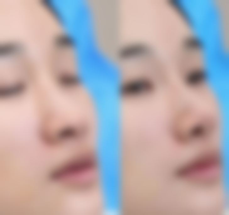 四、东莞星娅整形医院特色诊疗项目及技术优势