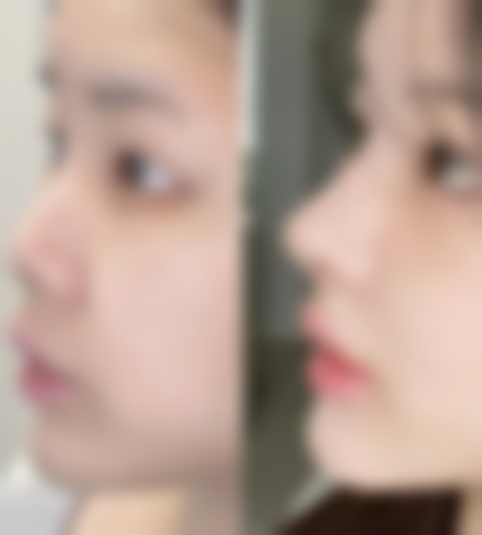 价格表 / 收费区间参考