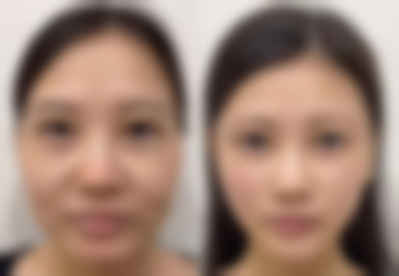 唇腭裂免费手术申请流程是怎样的