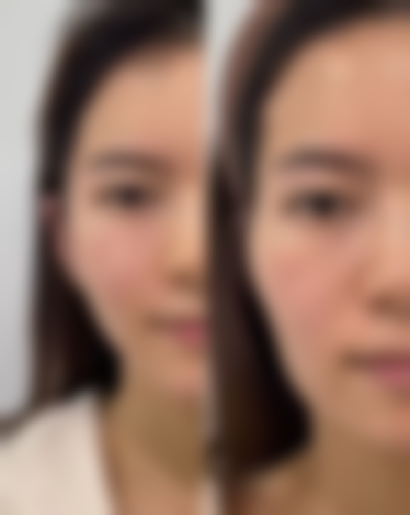 不同官网认证医生悦白之几胶原蛋白多少钱一支