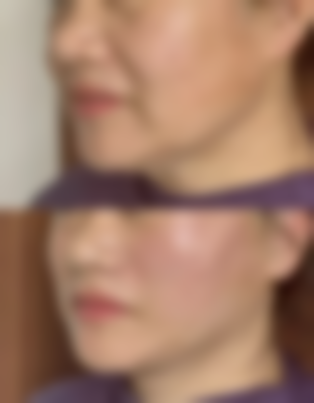 上饶市双博医疗美容患者常见问题解答