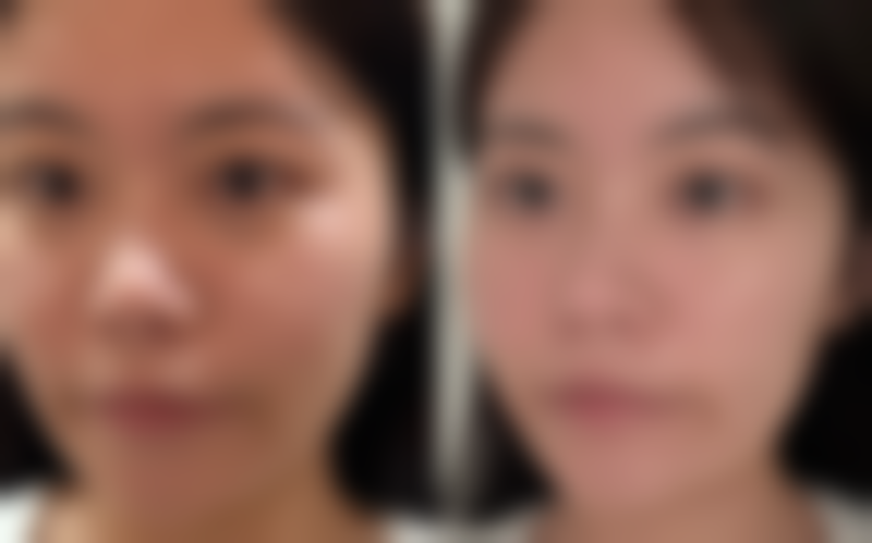 二、南京光尔美医疗美容诊所正规吗？