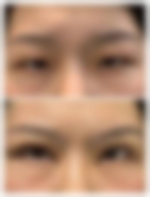 杭州康森整形医院正规可靠吗？