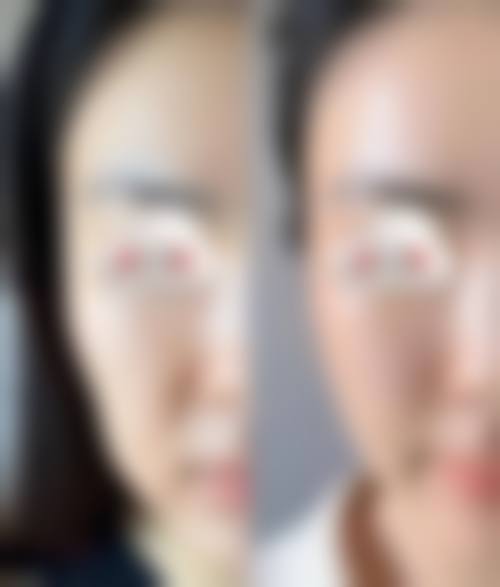 杭州康森整形医院预约挂号指南