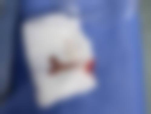 手术过程中的安心与信任