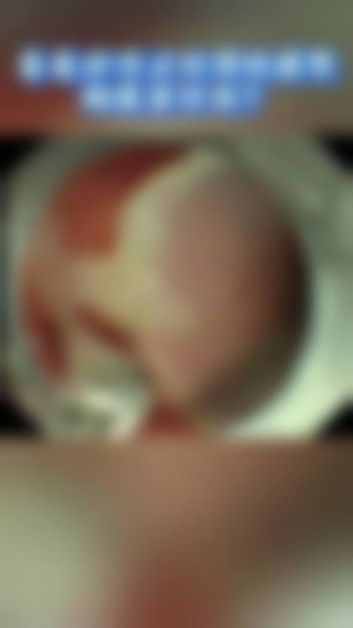 术后的蜕变与惊喜