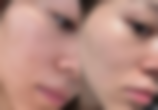 成都高新瑷尔博士整形医院口碑如何?