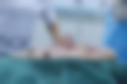 福州博美医学整形美容医院正规可靠吗？