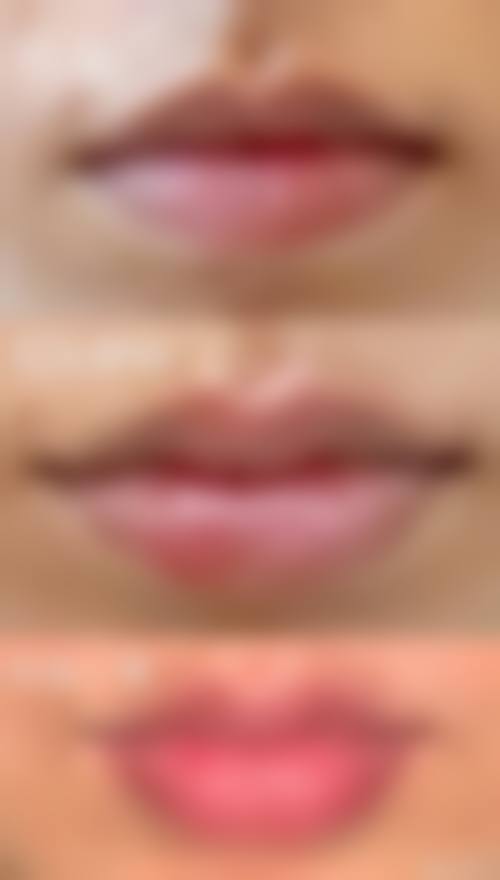 昆明陆庭芳整形美容诊所真人口碑评价怎么样？