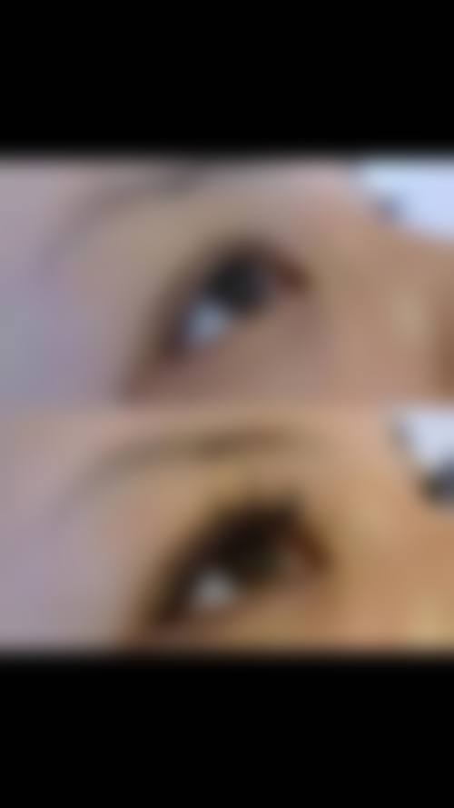 上海时光整形外科医院的睫毛特色