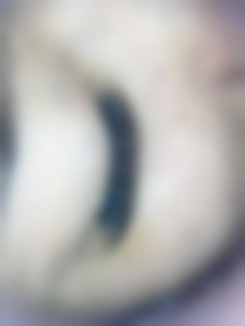 上海睫毛整形的注意事项