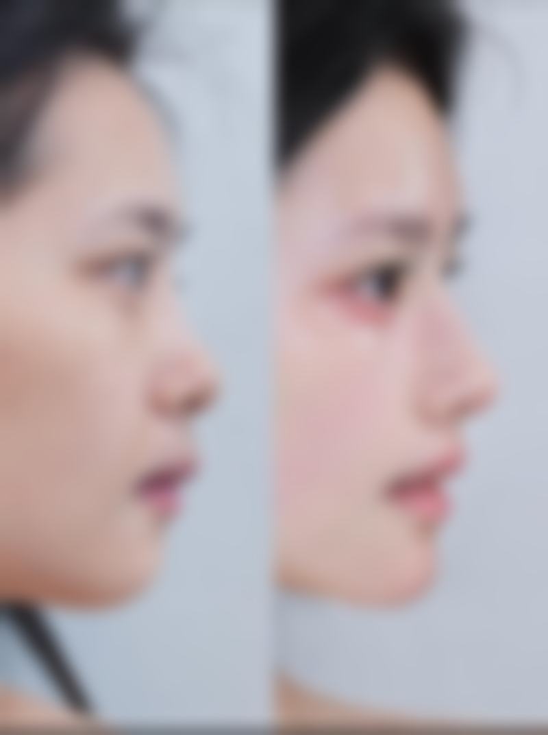 福州博美医学整形美容医院口碑如何？