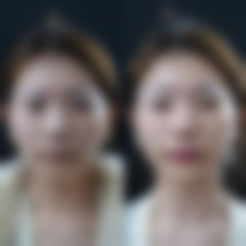 三、2026腭裂免费申请，可选择的定点医院