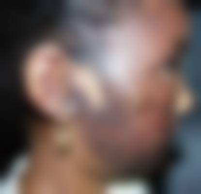 常州市第一人民医院整形烧伤科价目表