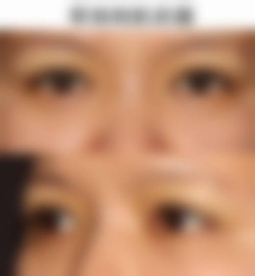 程开祥医生技术优势