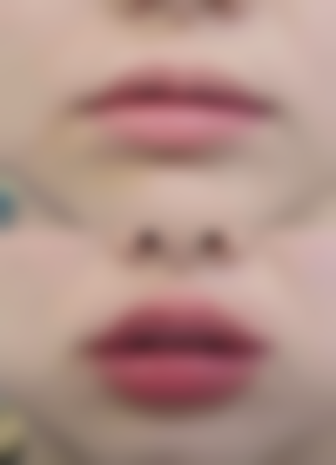 四、2026腭裂免费申请，具体的申请流程