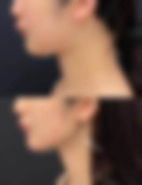 朱乐林塑造自然和谐妈生脸技巧