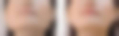 朱乐林保留原生颌面特色方式