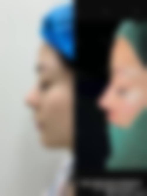 西安丁医生整形美容中 心医院特色技术及优质服务