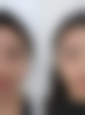 西安丁医生整形美容中 心价格表 / 收费标准一览