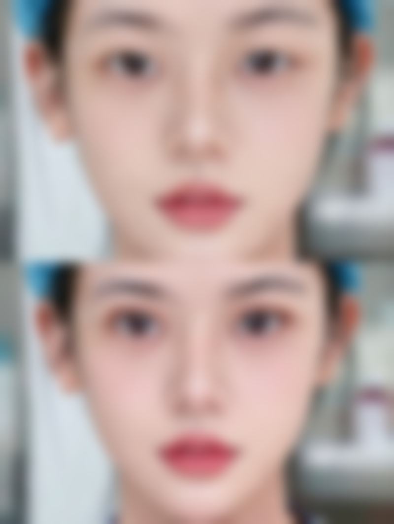 西安丁医生整形美容中 心预约挂号指南