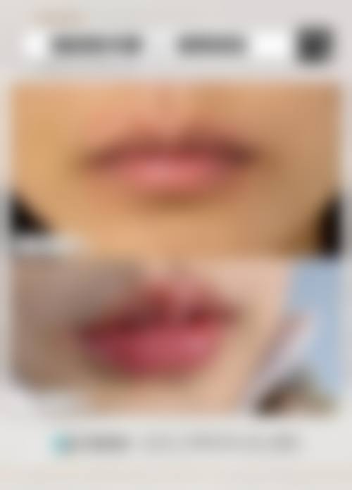 聊城青悦整形医院价格表 / 收费区间参考