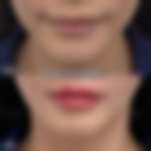 聊城青悦整形医院地址电话及到院路线