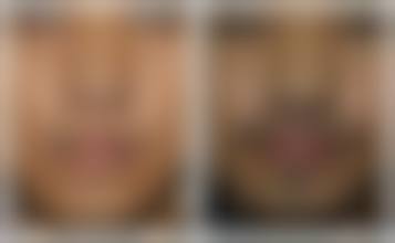 广西钦州赫珀医疗美容诊所详细的预约挂号方式及流程