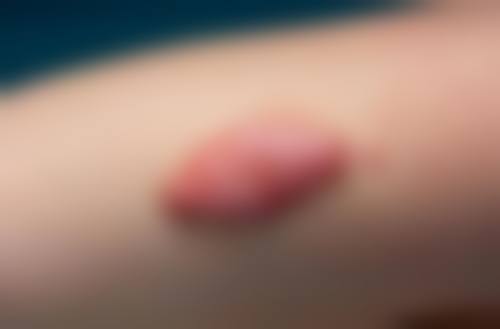 杨东运的患者口碑与真实实例