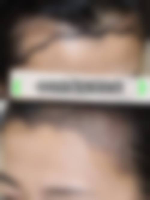 上海微蓝医疗美容门诊部预约挂号指南