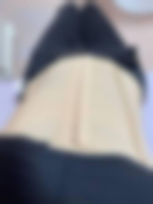 韩国inmode瘦身适应人群