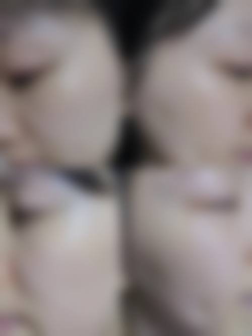 {成都李修肤华塑整形纹身清除价格未明确，李晓东医生用高精度激光分层祛纹身成效显著 