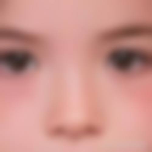 河北医 科 大学中医院美容科患者常见问题解答