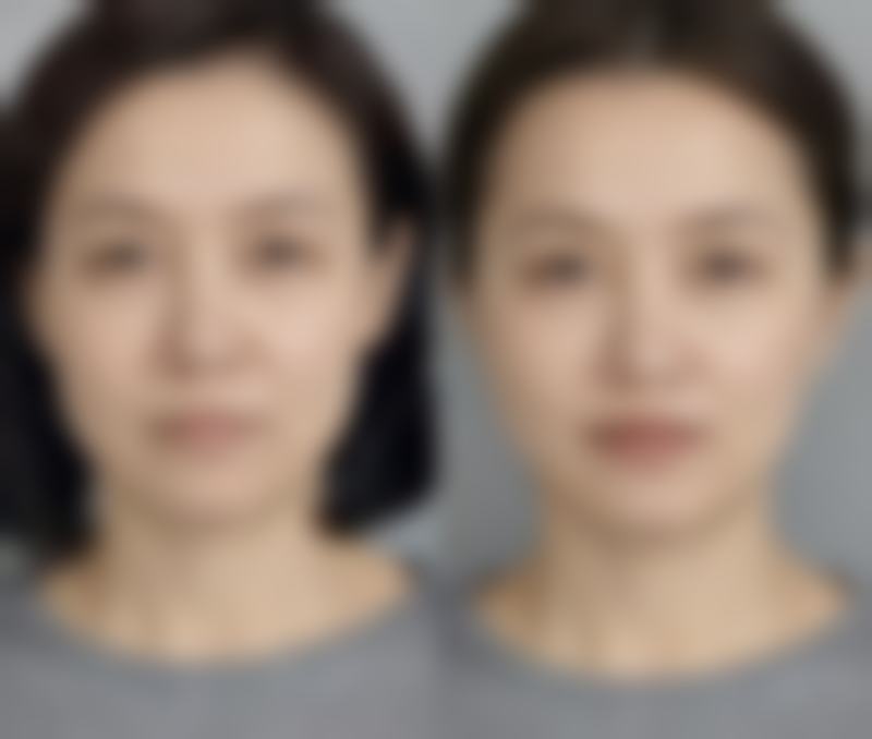 镇江歌美整形医院擅长项目