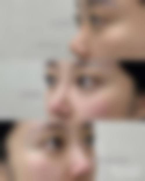 六、南宁市第二人民医院整形美容外科口碑怎么样