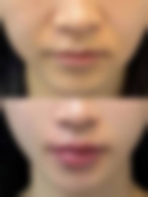 二、锦州海峰整形医疗美容诊所是正规医院吗？