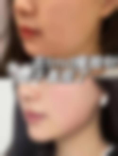 八、温州市龙湾艳后医疗美容门诊部预约挂号方式及流程