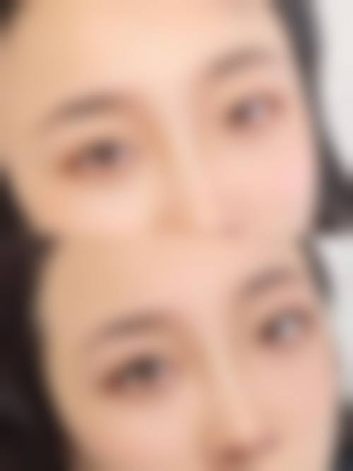 六、太原万美整形医院口碑怎么样？