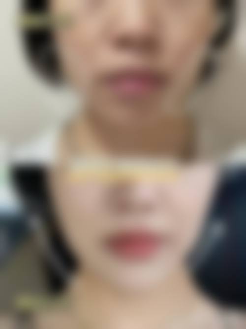 七、太原万美整形医院预约挂号方式及流程