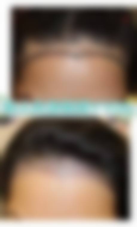 五、贵阳星妍芭莎美容医院植发科收费价格表