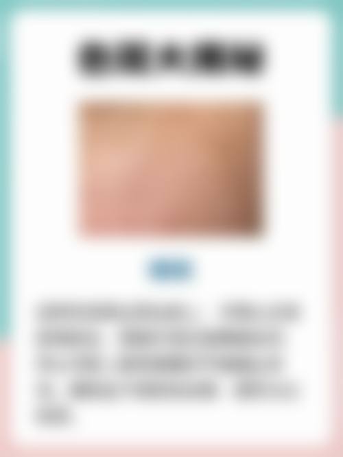 六、韩国奥俪颜皮肤科口碑怎么样