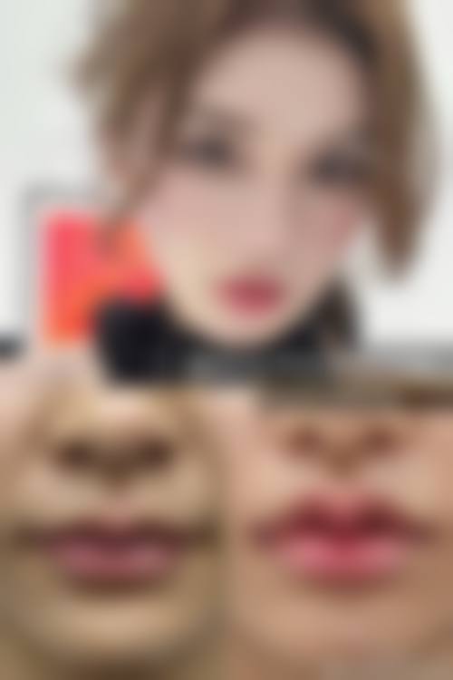 昆明雪然医美(顺城诊所)详细的预约挂号方式及流程