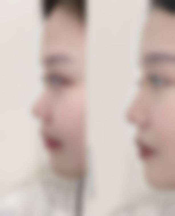 韩国好棒整形外科医院特色技术及优质服务