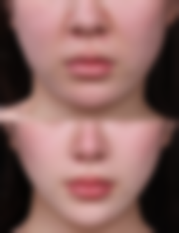 韩国好棒整形外科口碑如何?