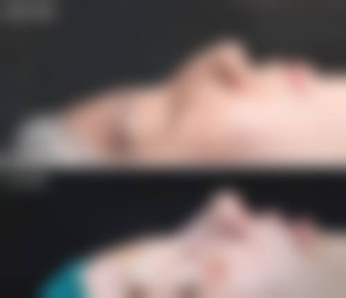 韩国心美眼整形正规可靠吗?